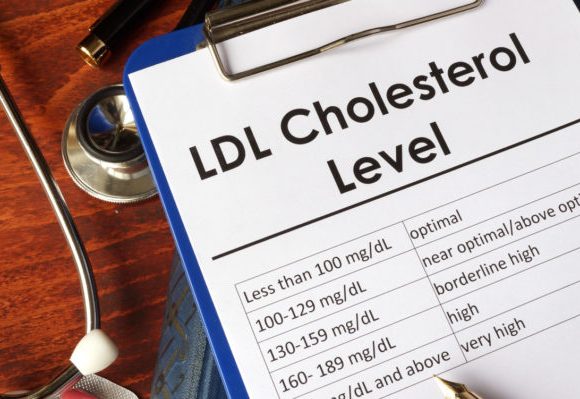 Πώς-πέφτει-η-ldl-χοληστερόλη-–-Τι-πρέπει-να-γνωρίζετε